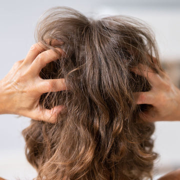 Why Is My Scalp So Itchy And Flaky?