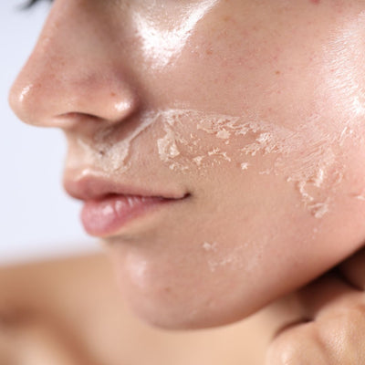 Skincare for Dry Skin