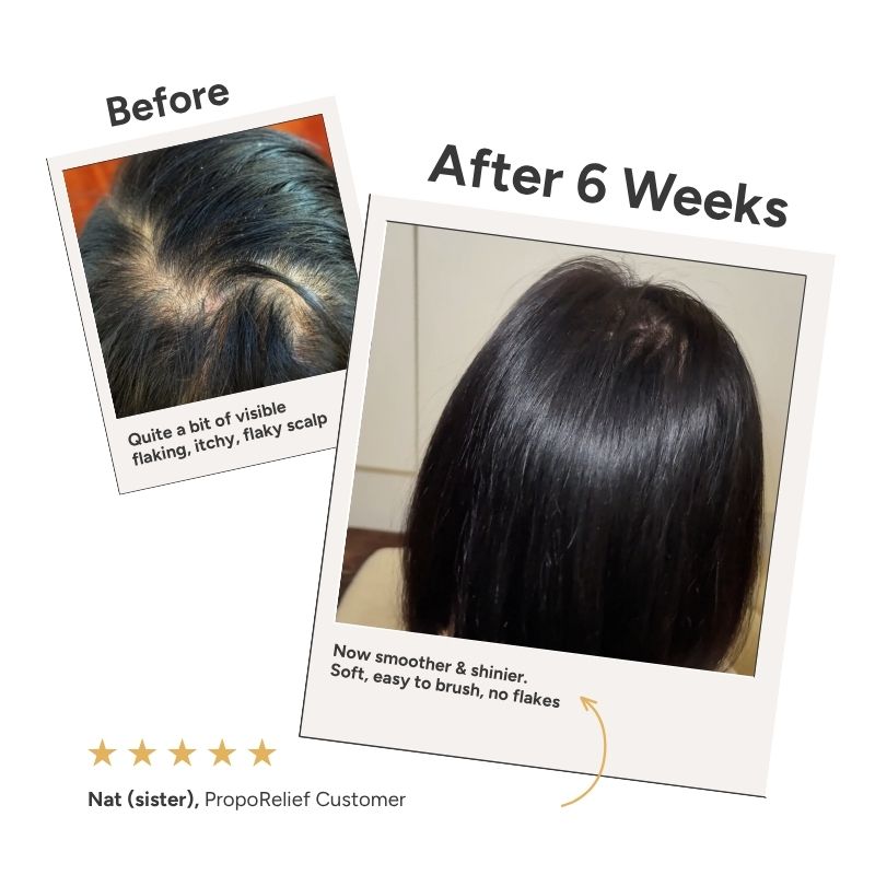 PropoRelief Shampoo & Conditioner Set